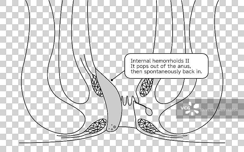 截面图图片素材