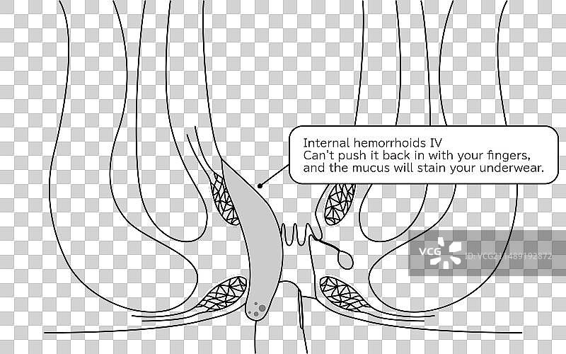 截面图图片素材