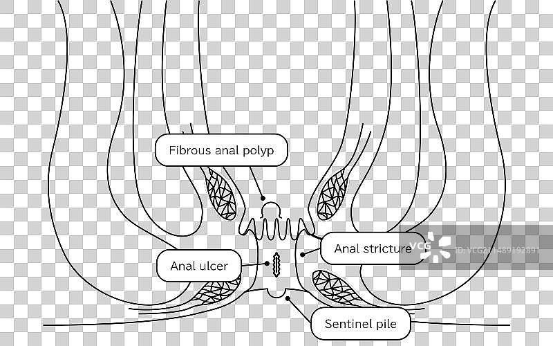 截面图图片素材