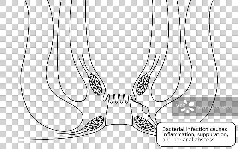 截面图图片素材