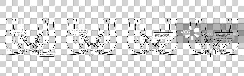 截面图图片素材