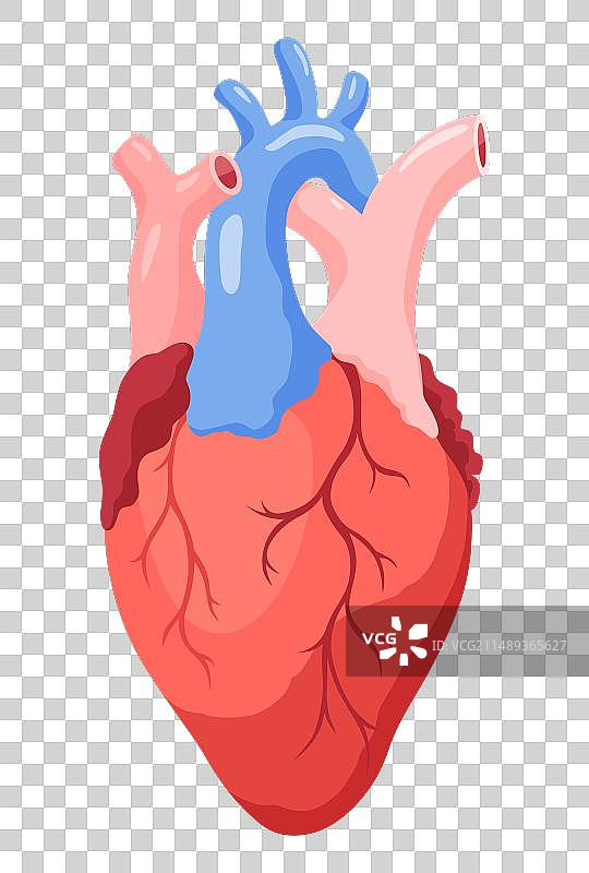 动脉粥样硬化心脏病发作解剖图图片素材