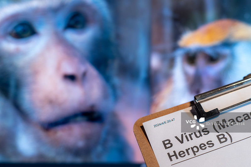 B病毒,疱疹病毒B,猴疱疹病毒,疱疹病毒B,人B病毒,医疗防疫概念主题图片素材