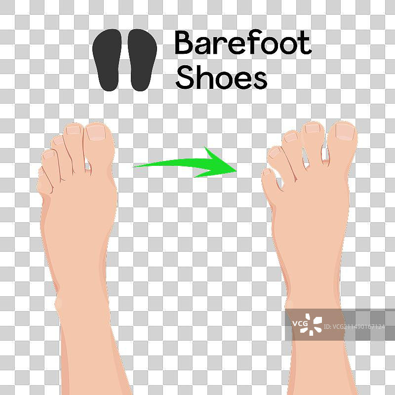 赤足鞋前后足部对比图片素材