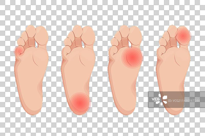 足部和脚趾疼痛设计图片素材