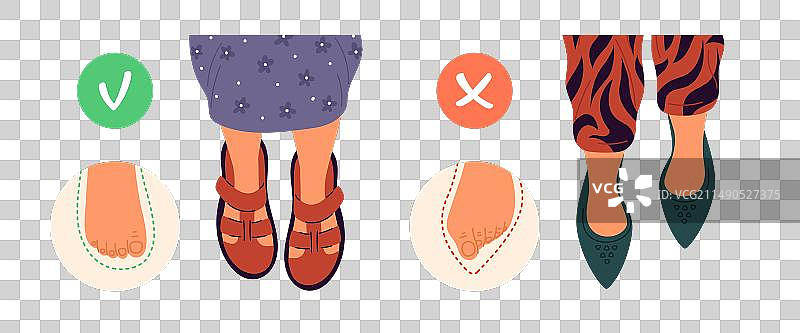 女性健康足部护理与鞋子引起的足部畸形图片素材