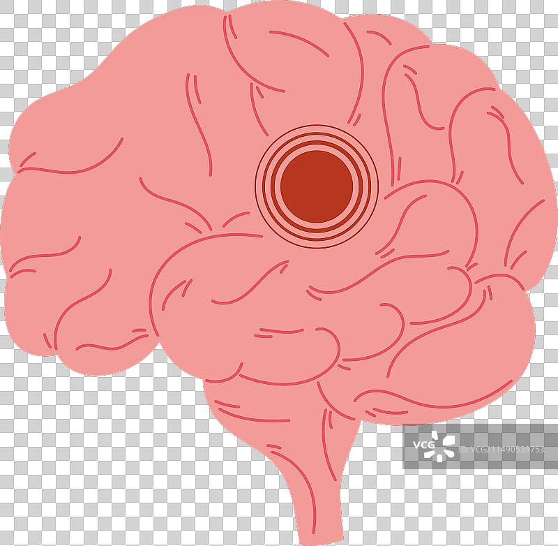 世界帕金森日脑部疾病图片素材