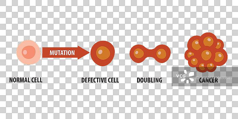 癌症发展过程图片素材