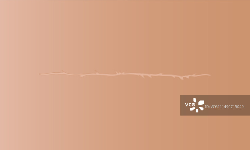 皮肤伤口疤痕缝合图片素材