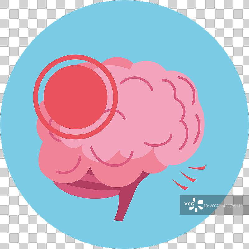 帕金森神经系统疾病图片素材