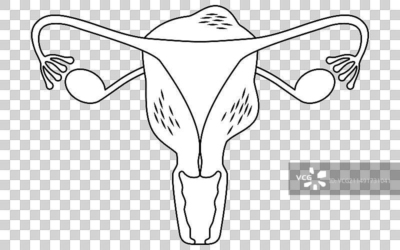 子宫腺肌症解剖图图片素材