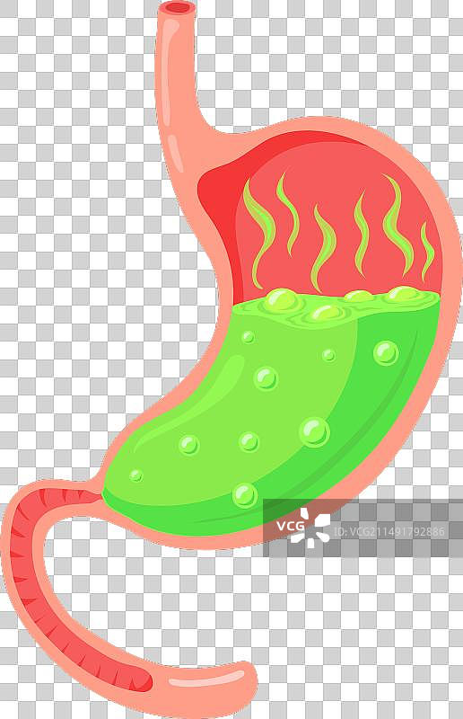 胃酸反流消化疼痛症状图片素材