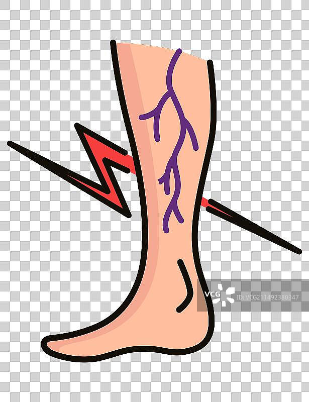 静脉曲张治疗图标违反循环图片素材