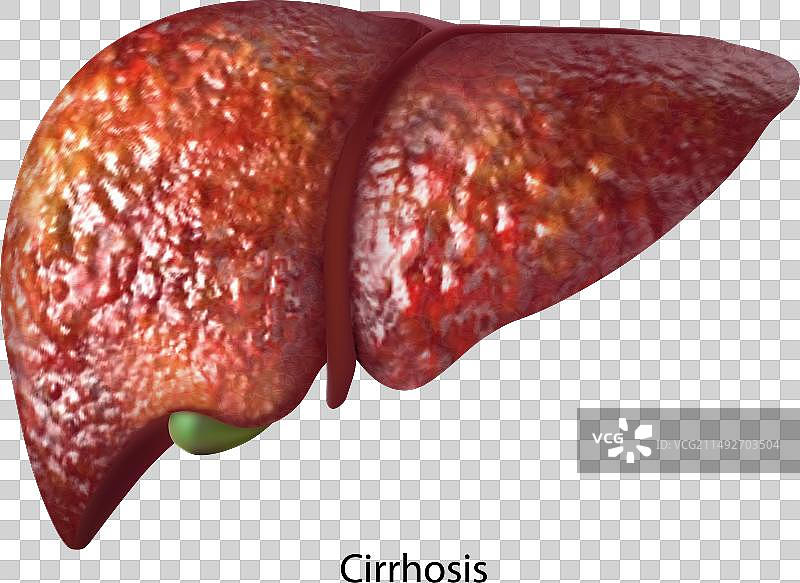 孤立的病肝图片素材