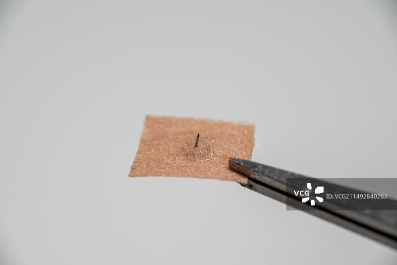 揿针也叫皮内针、耳针，是一种带针的针灸贴，用于临床治疗内外妇儿的疾病，中医辅助治疗法图片素材