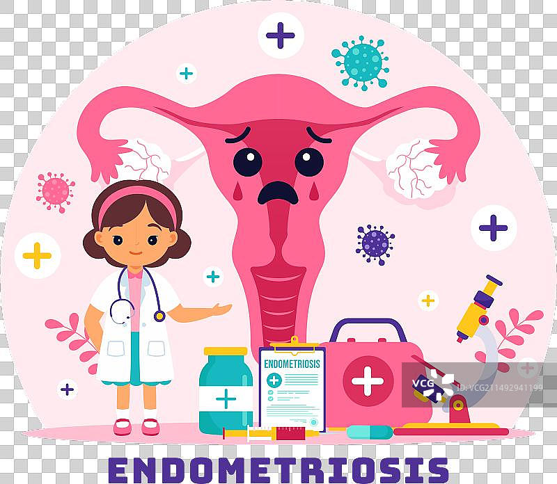 子宫内膜异位症与子宫内膜图片素材