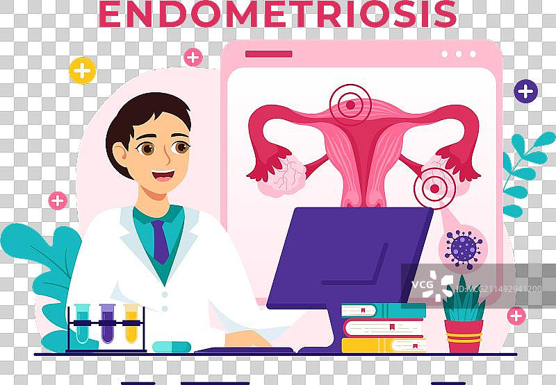 子宫内膜异位症与子宫内膜图片素材
