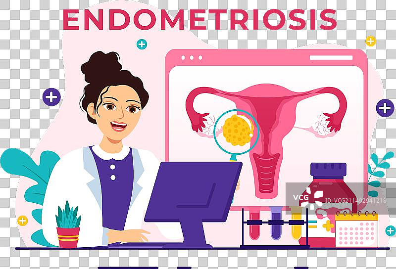 子宫内膜异位症与子宫内膜图片素材