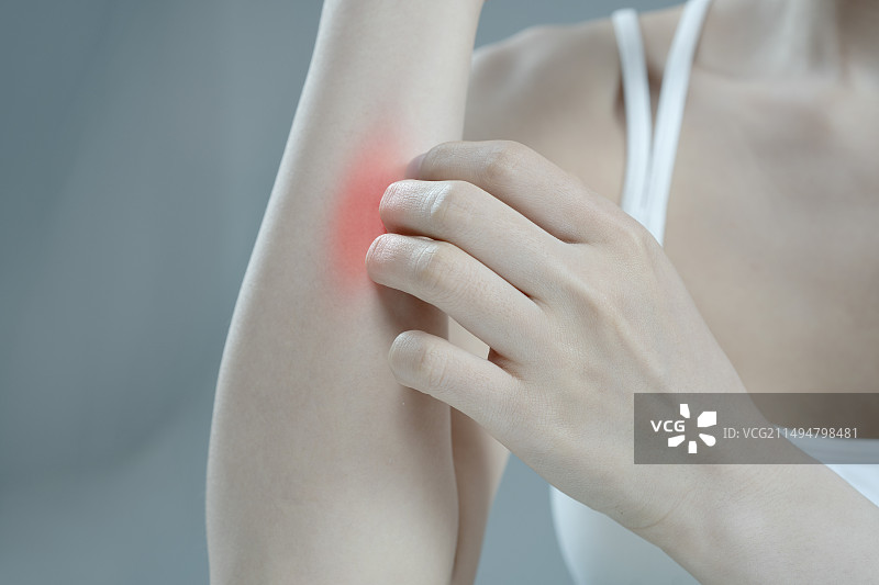 皮肤瘙痒难受的年轻女人图片素材