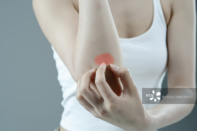 皮肤瘙痒难受的年轻女人图片素材