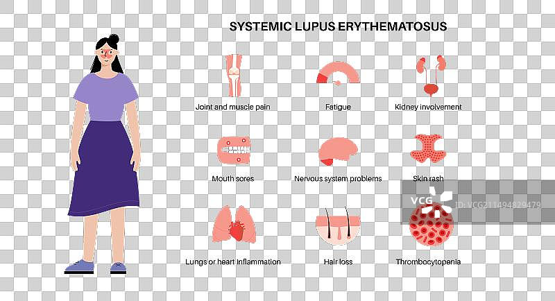 系统性红斑狼疮图片素材