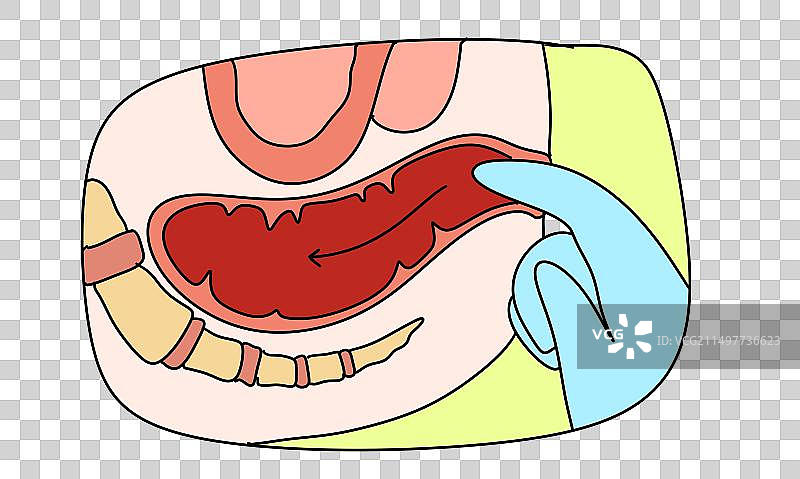 痔疮，肛门，指检，肛肠科，内科，描边风格简笔画设计元素图片素材