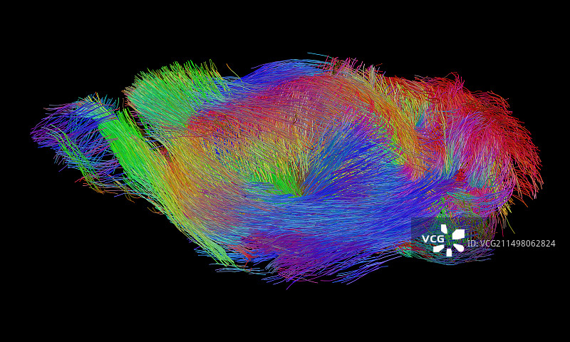 小鼠脑白质纤维DTI核磁共振扫描图片素材