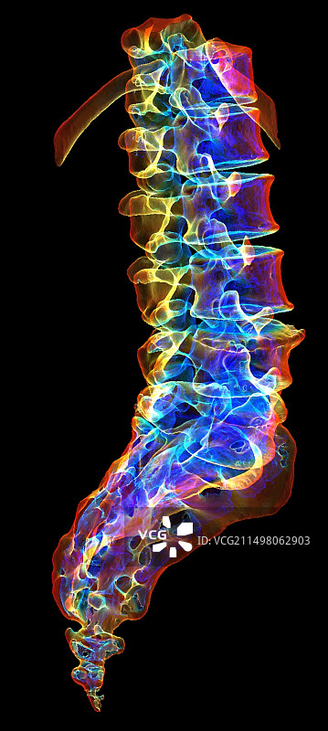 腰骶椎，3D CT扫描图片素材
