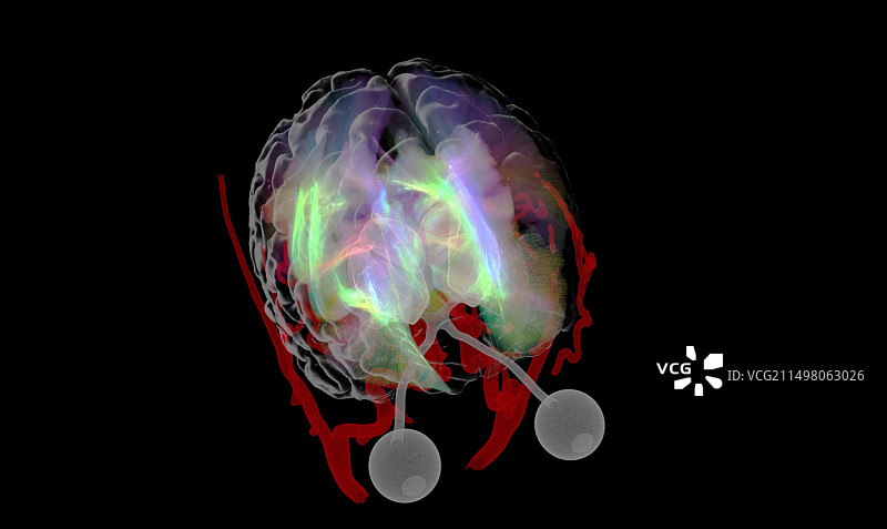 白质纤维DTI MRI扫描图片素材