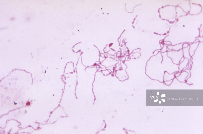 鼠咬热细菌显微照片图片素材