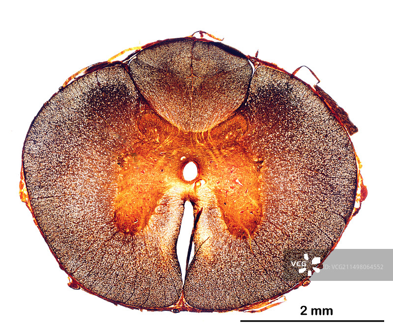 人类脊髓显微照片图片素材