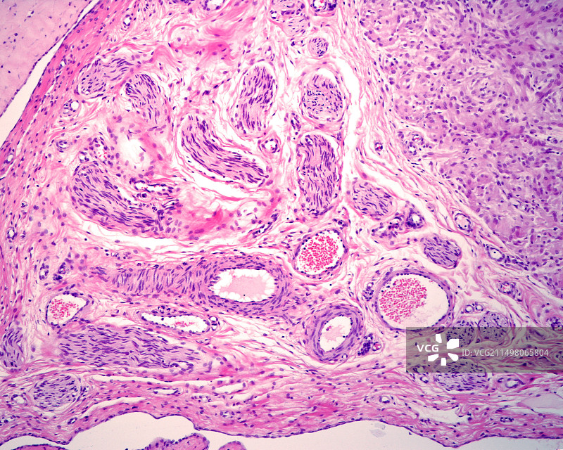 血管和神经显微照片图片素材