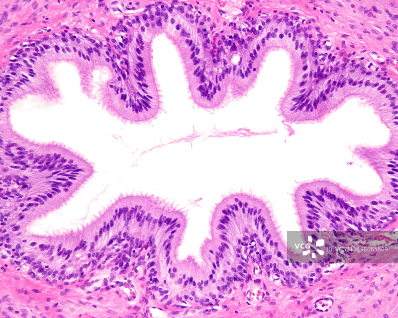 输精管显微照片图片素材