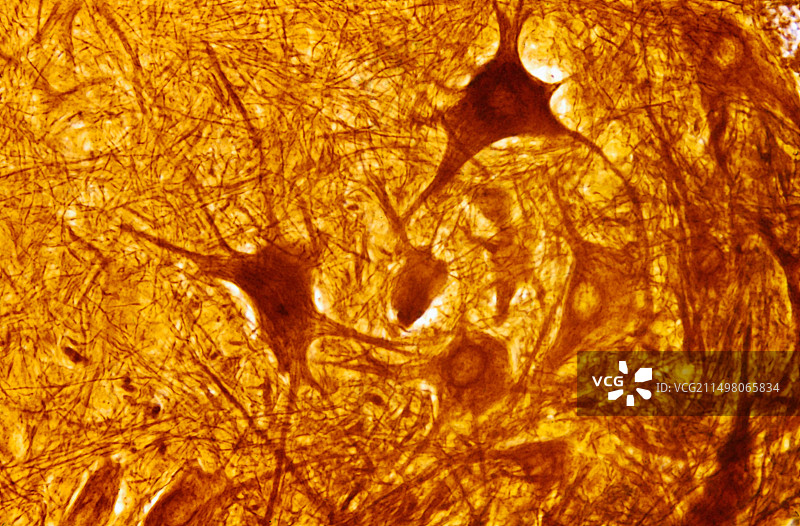 脊髓多极神经元显微照片图片素材