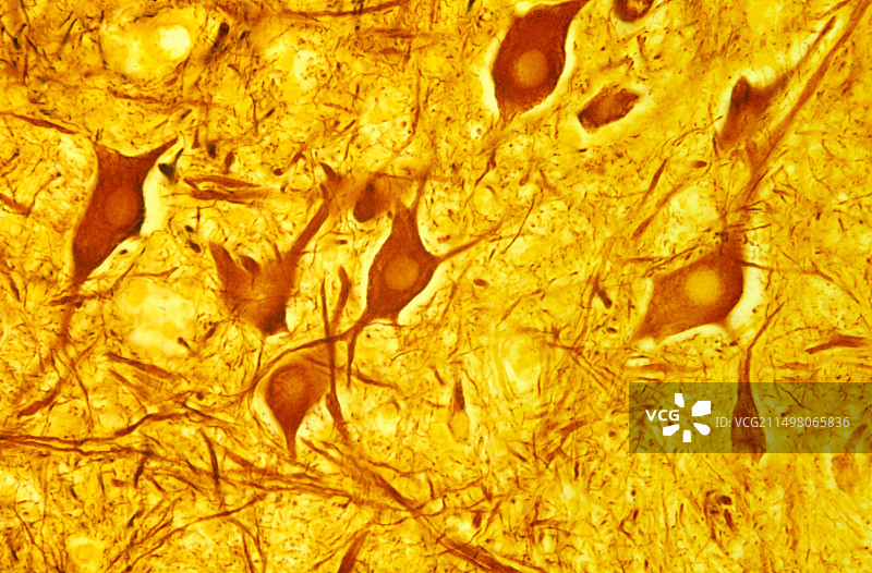 脊髓多极神经元显微照片图片素材