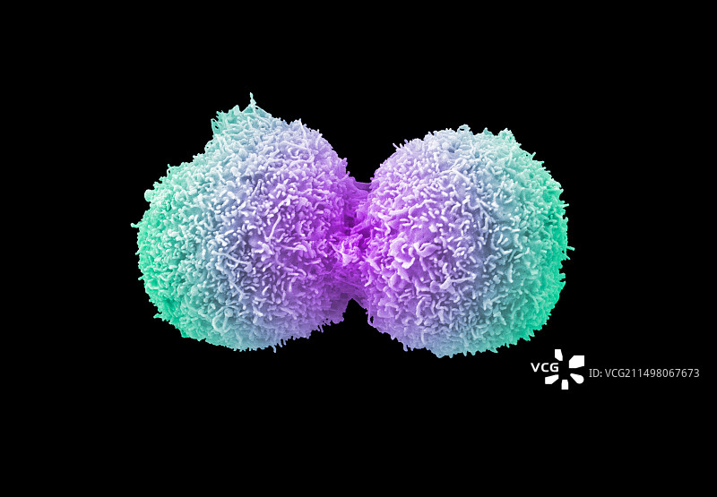 肺癌细胞分裂扫描电镜图图片素材