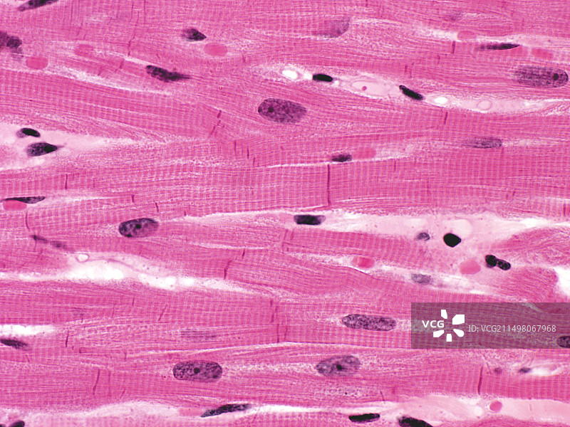 心肌组织光学显微照片图片素材
