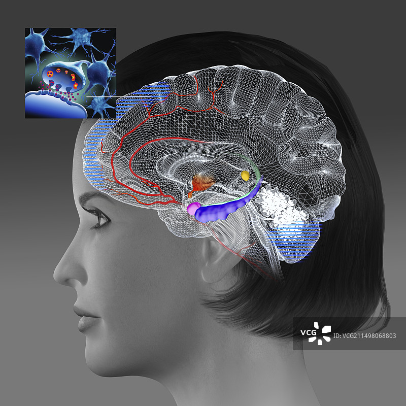 运动对阿尔茨海默病患者大脑的影响图片素材