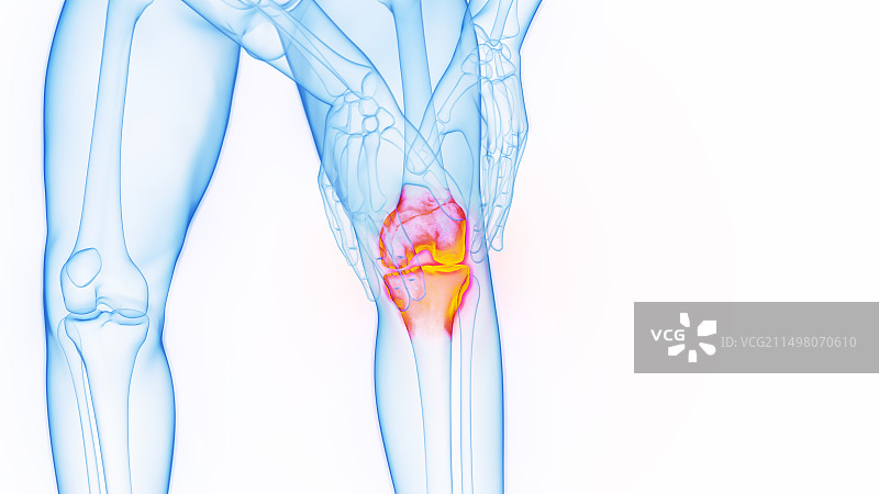 膝盖疼痛插画图片素材