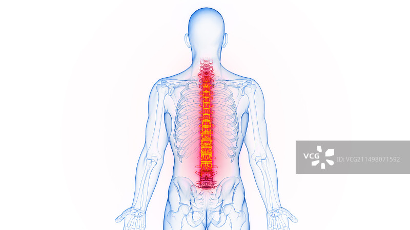 脊柱炎症插图图片素材