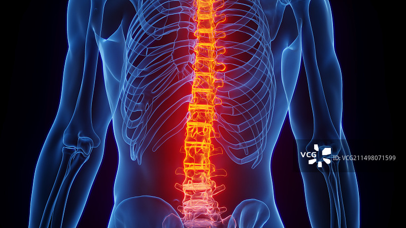 脊柱炎症插图图片素材
