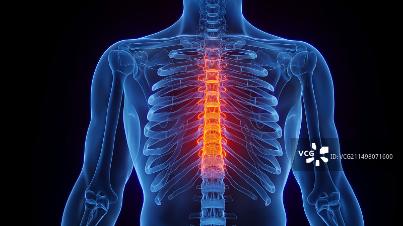 胸椎炎症插图图片素材