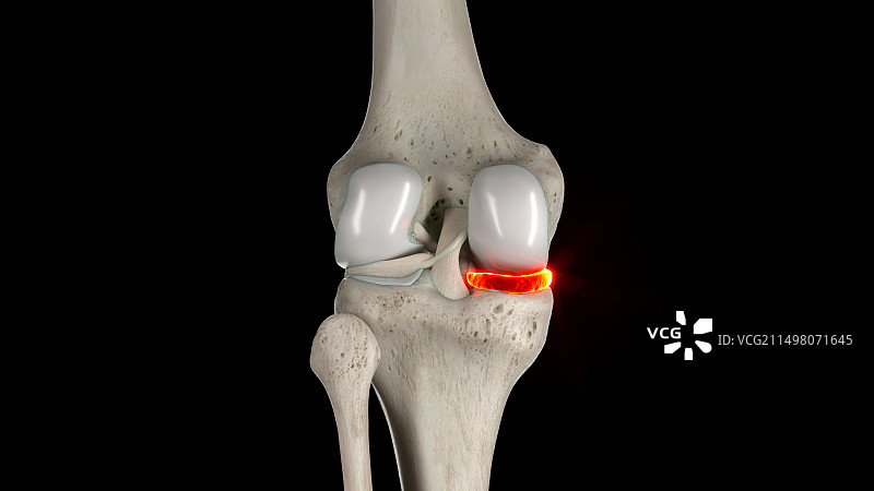 内侧半月板插图图片素材