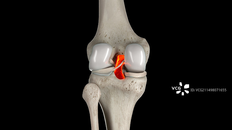 后十字韧带插图图片素材