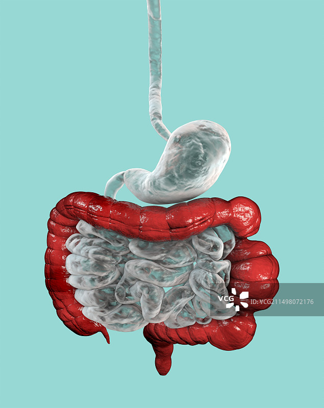 肠易激综合征插图图片素材