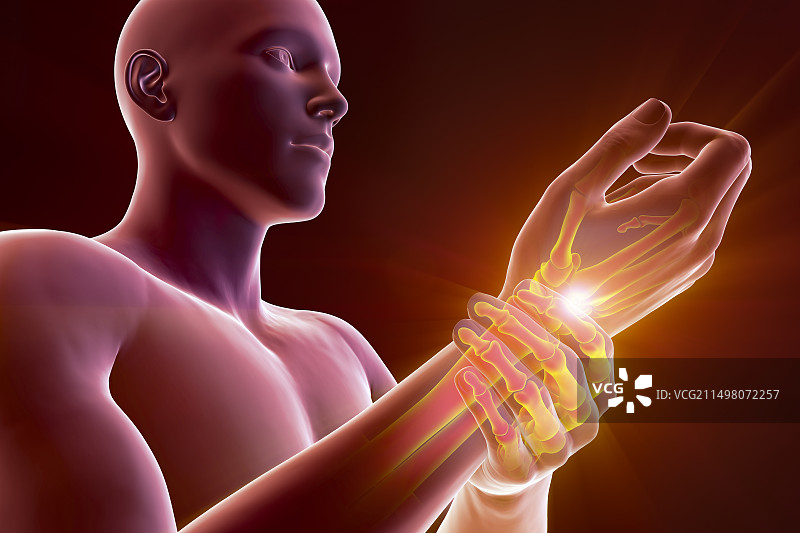 手腕疼痛插画图片素材