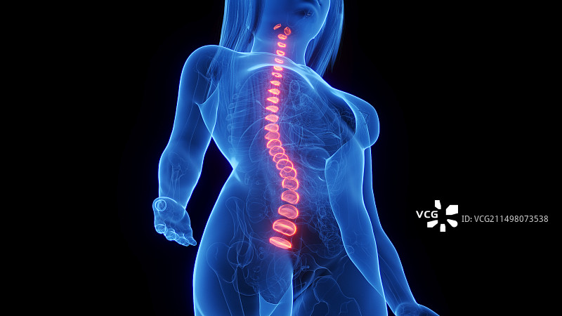 椎间盘图示图片素材