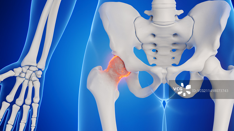男性髋关节插图图片素材
