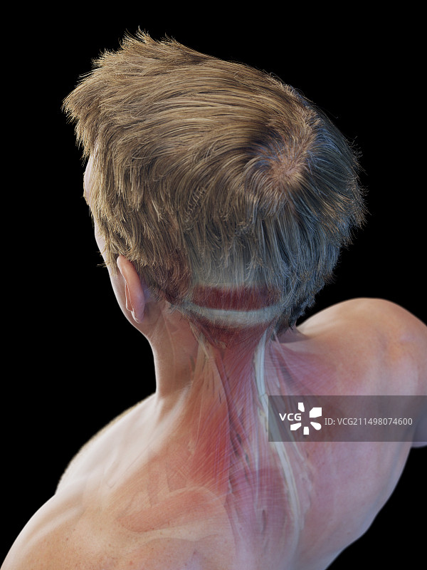 男性颈部浅层肌肉图图片素材