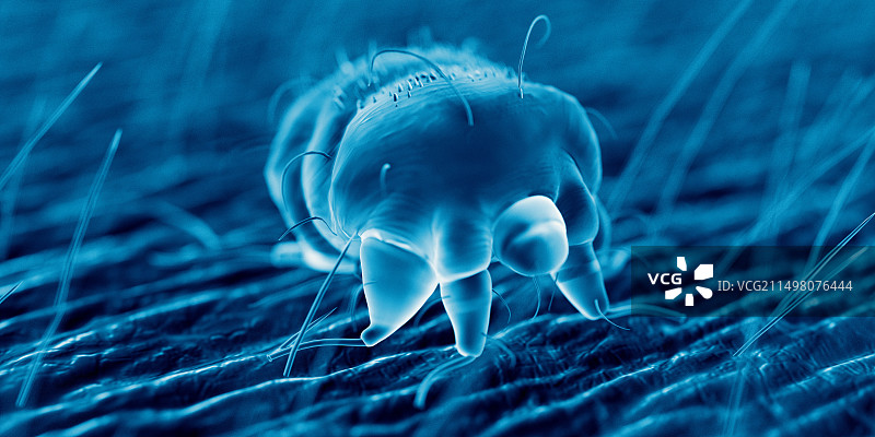 人体皮肤上的疥螨，图解图片素材